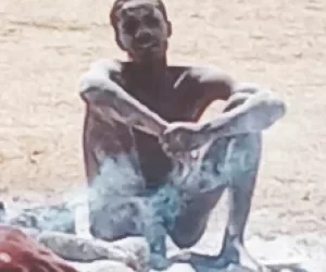 Harare Man Dies After He Cuts His Own Flesh And Eats It