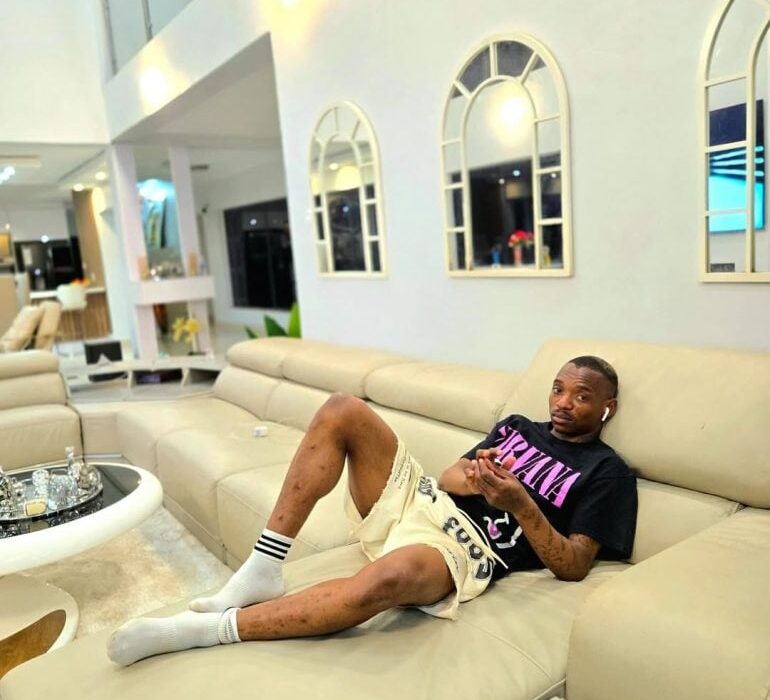 No Kaizer Chiefs No Problem: Khama Billiat set to make history with Scotland