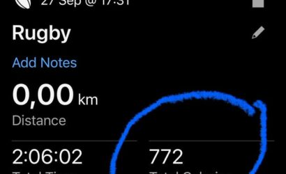 It’s not easy: Springboks coach Rassie Erasmus’ lost calories against Argentina